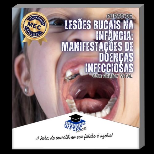 Curso de Lesões Bucais na Infância: Manifestações de Doenças Infecciosas